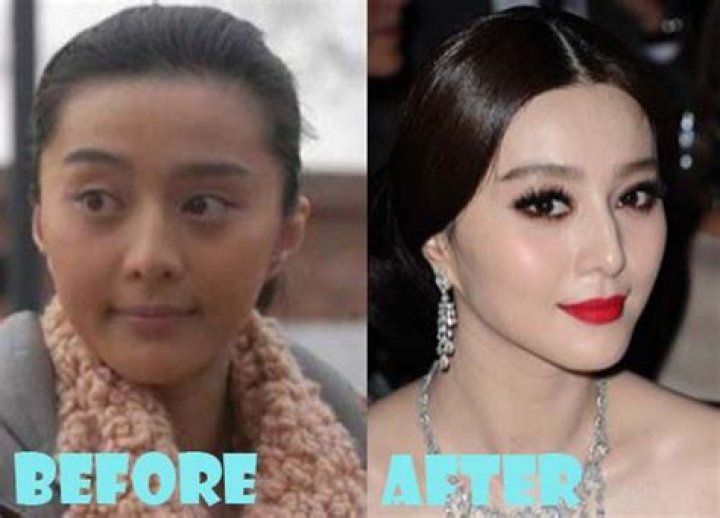 Did Fan Bingbing Have Plastic Surgery? 2022 Rumors Explained!